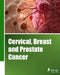 Cervical, Breast and Prostate Cancer (Classical Cover) by Iconcept Press