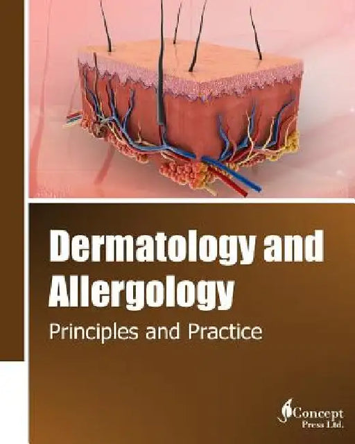 Dermatology and Allergology: Principles and Practice by Iconcept Press