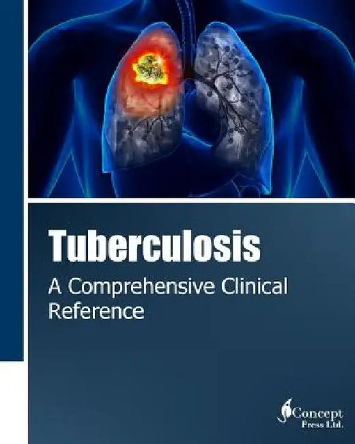 Tuberculosis: A Comprehensive Clinical Reference by Iconcept Press