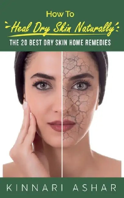 How to Heal Dry Skin Naturally: The 20 Best Dry Skin Home Remedies by Kinnari Ashar