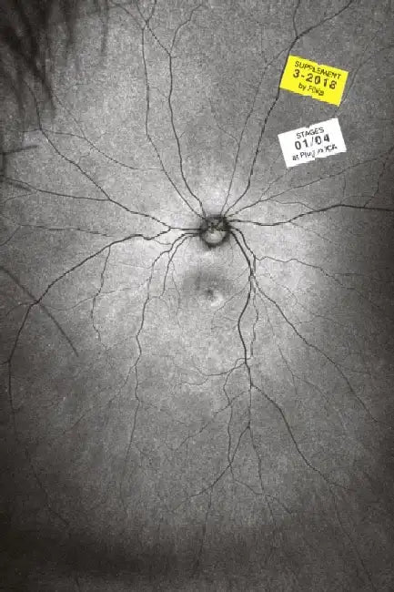 Supplement 3: The Invention and Conclusion of the Eye by Toril Johannessen