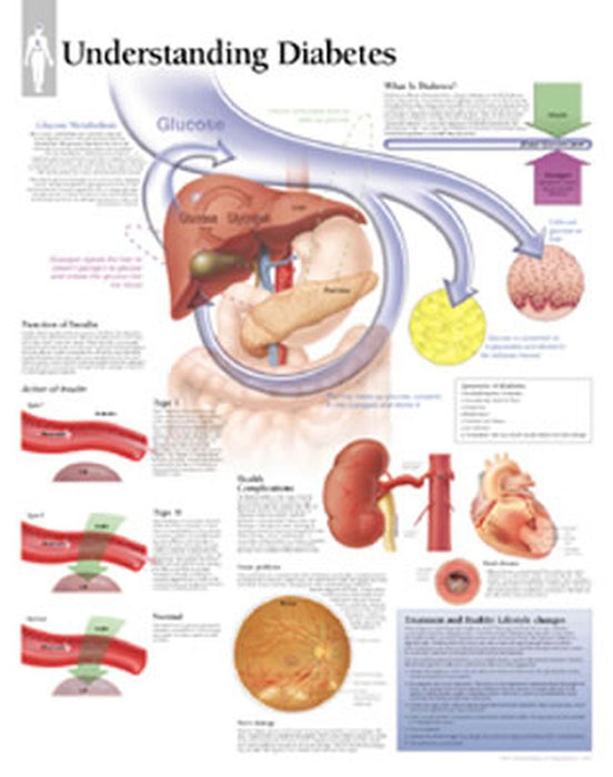 Understanding Diabetes Paper Poster by Unknown