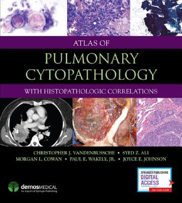 Atlas of Pulmonary Cytopathology by Christopher J. Vandenbussche, Syed Z. Ali, Anil V. Parwani