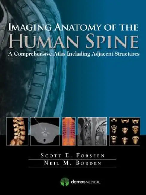 Imaging Anatomy of the Human Spine: A Comprehensive Atlas Including Adjacent Structures by Scott E. Forseen, Neil M. Borden