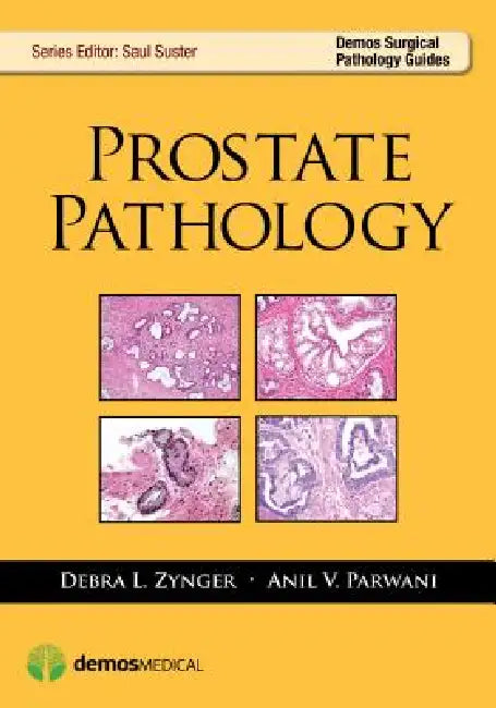 Prostate Pathology by Debra Zynger, Anil V. Parwani, Saul Suster