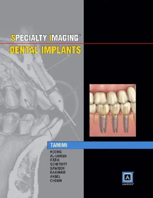 Specialty Imaging: Dental Implants by Dania Tamimi