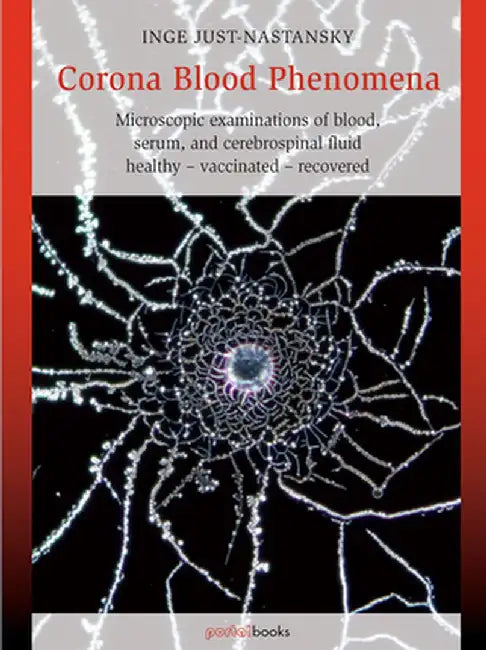 Corona Blood Phenomena: Microscopic Examinations of Blood, Serum, and Cerebrospinal Fluid: Healthy - Vaccinated - Recovered by Inge Just-Nastansky