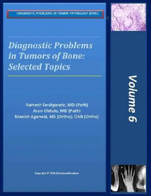 Diagnostic Problems in Bone Tumors: Selected Topics by Arun R. Chitale