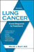 Lung Cancer: From Diagnosis to Treatment by Walter Scott
