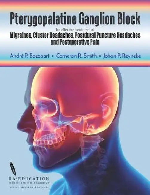 Pterygopalatine Ganglion Block: for effective treatment of Migraine, Cluster Headache, Postdural Puncture Headache & Postoperative Pain by Cameron R. Smith