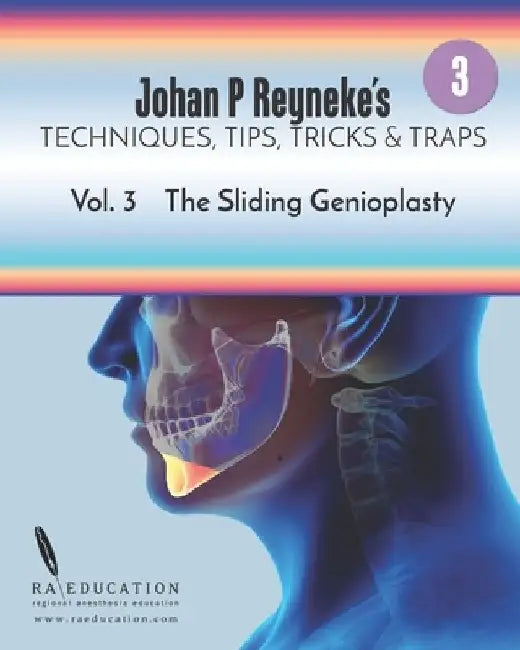 Johan P. Reyneke's Techniques, Tips, Tricks and Traps Vol 3: The Sliding Genioplasty by Johan P. Reyneke