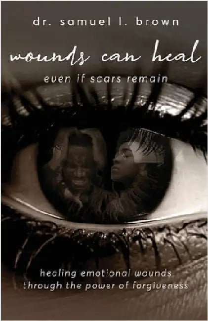 Wounds Can Heal, Even If Scars Remain by Brown, Samuel