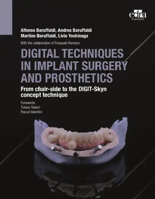 Digital Techniques in Implant Surge / Baruffaldi (C) by Alfonso Baruffaldi