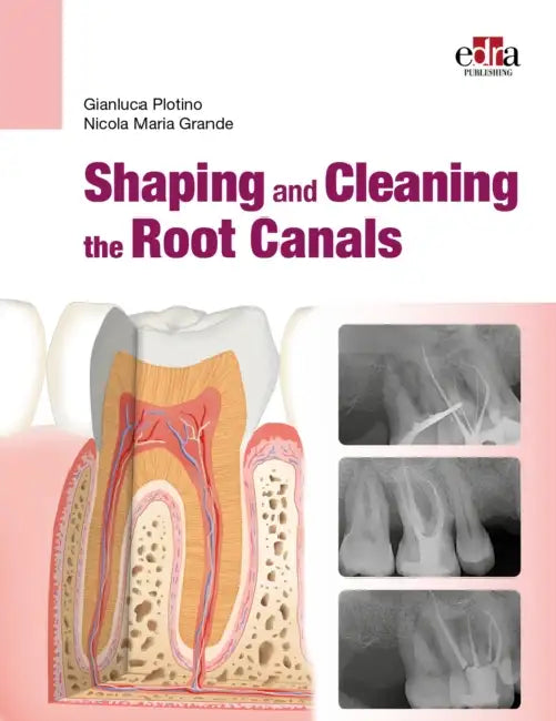 Shaping and Cleaning the Root Canals by Gianluca Plotino Dds Phd, Nicola Maria Grande Dds Phd