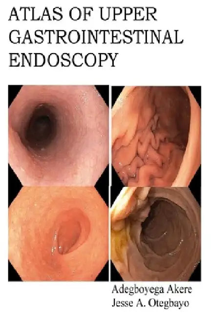 Atlas of Upper Gastrointestinal Endoscopy by Jesse Abiodun Otegbayo