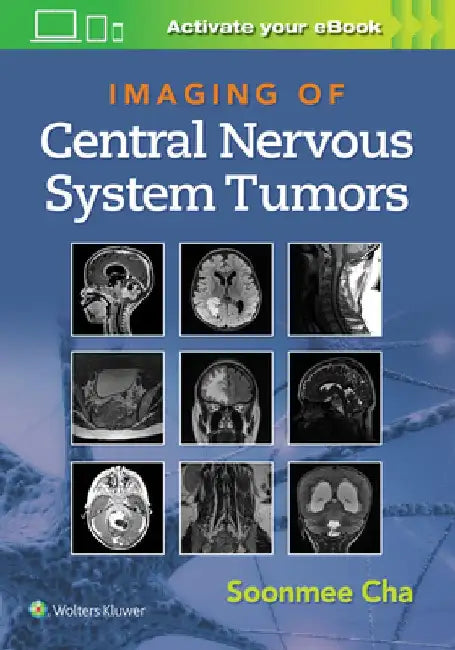Imaging of Central Nervous System Tumors by Soonme Cha