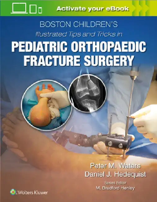 Boston Children's Illustrated Tips and Tricks in Pediatric Orthopaedic Fracture Surgery by Peter M. Waters