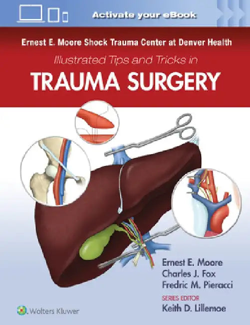 Ernest E. Moore Shock Trauma Center at Denver Health Illustrated Tips and Tricks in Trauma Surgery by Ernest E. Moore