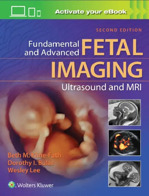 Fundamental and Advanced Fetal Imaging Ultrasound and MRI by Beth Kline-Fath, Dorothy Bulas, Wesley Lee