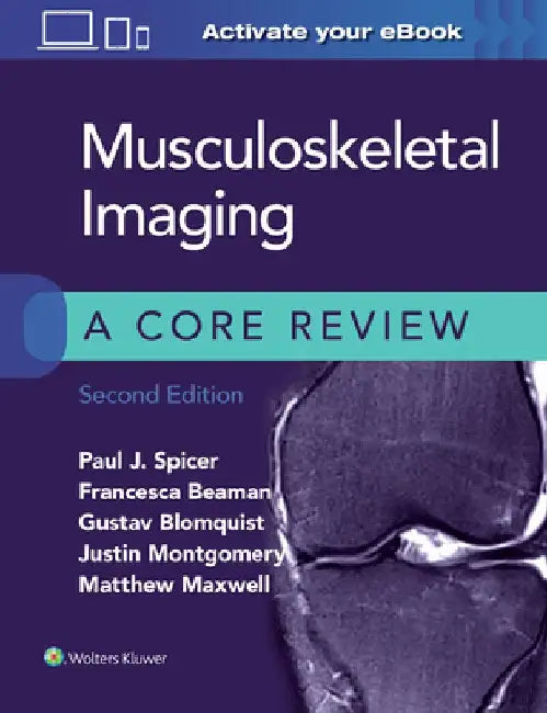 Musculoskeletal Imaging: A Core Review by Paul Spicer