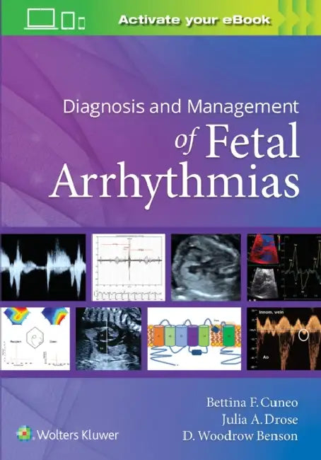 Diagnosis and Management of Fetal Arrhythmias by Bettina Cuneo, Julia Drose, D. Woodrow Benson