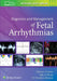 Diagnosis and Management of Fetal Arrhythmias by Bettina Cuneo, Julia Drose, D. Woodrow Benson