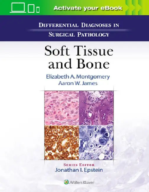 Differential Diagnoses in Surgical Pathology: Soft Tissue and Bone by Elizabeth A. Montgomery