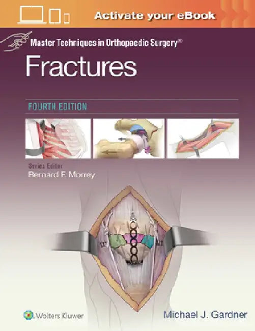 Master Techniques in Orthopaedic Surgery: Fractures by Michael J. Gardner