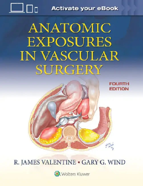 Anatomic Exposures in Vascular Surgery by Wind Gary G.