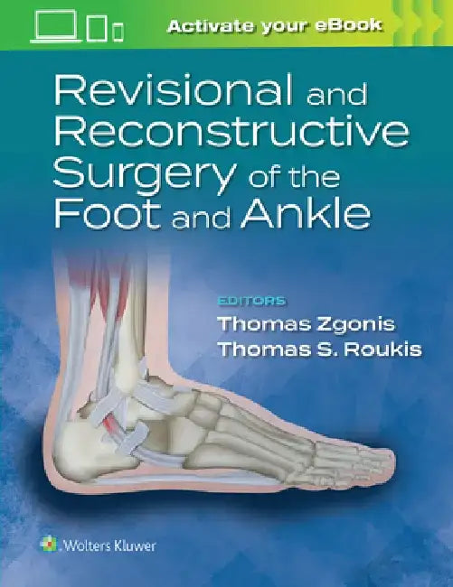 Revisional and Reconstructive Surgery of the Foot and Ankle by Thomas Zgonis