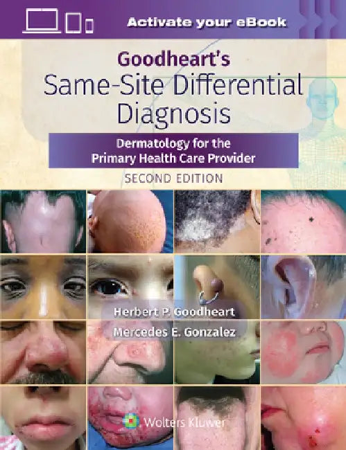 Goodheart's Same-Site Differential Diagnosis: Dermatology for the Primary Health Care Provider by Herbert Goodheart
