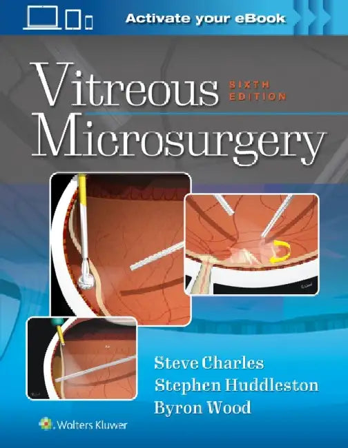 Vitreous Microsurgery by Steve Charles