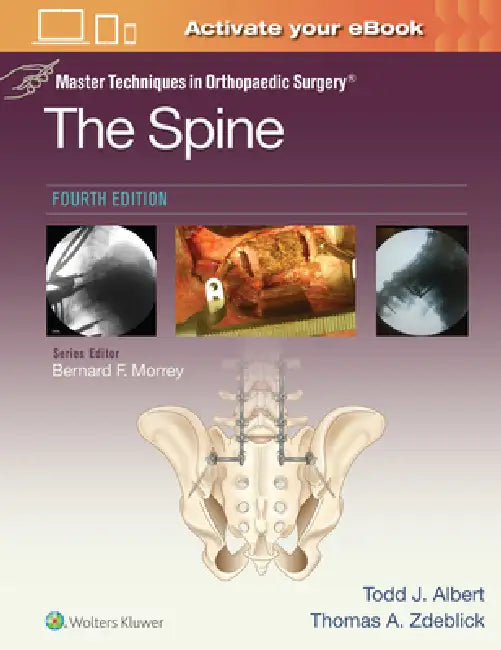 Master Techniques in Orthopaedic Surgery: The Spine by Todd Albert, Thomas A. Zdeblick