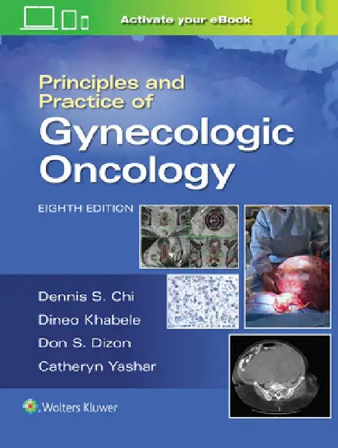 Principles and Practice of Gynecologic Oncology by Dennis Chi