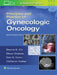 Principles and Practice of Gynecologic Oncology by Dennis Chi