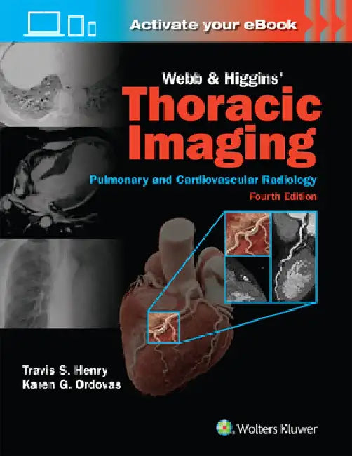 Webb & Higgins Thoracic Imaging: Print + eBook with Multimedia by Travis Henry