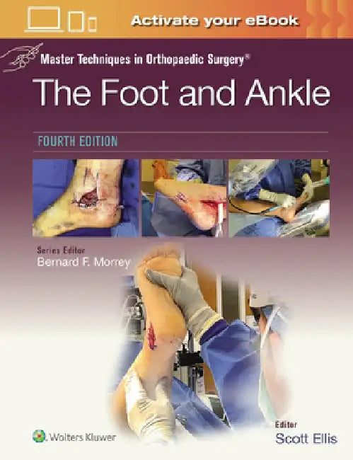 Master Techniques in Orthopaedic Surgery: The Foot and Ankle by Scott Ellis