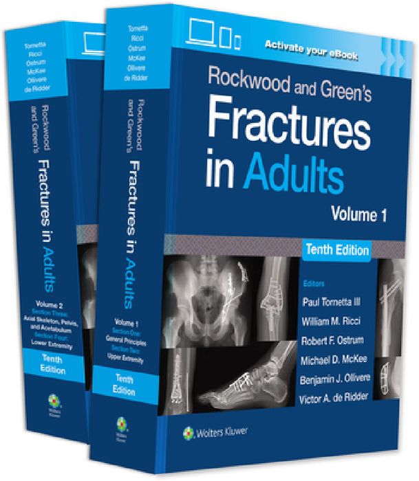 Rockwood and Green's Fractures in Adults: Print + eBook with Multimedia by Paul, MD, III Tornetta