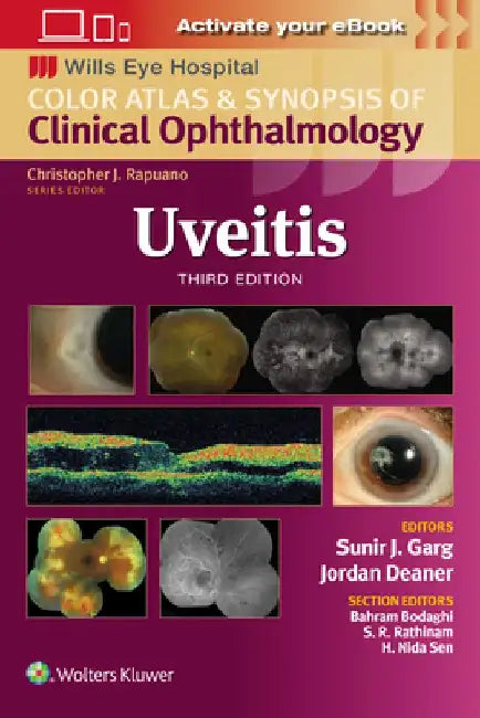 Uveitis by Sunir J. Garg
