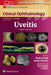 Uveitis by Sunir J. Garg