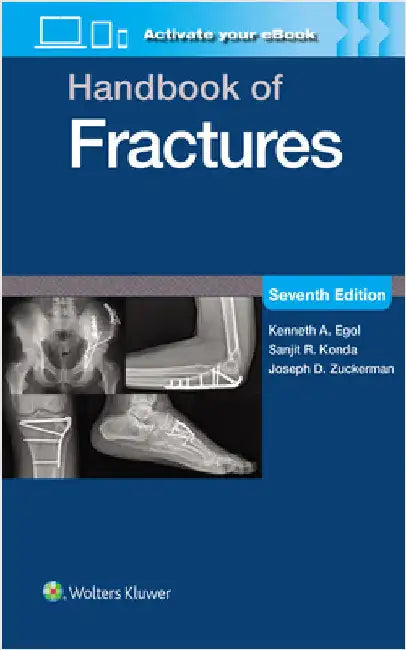 Handbook of Fractures: Print + eBook with Multimedia by Kenneth A. Egol