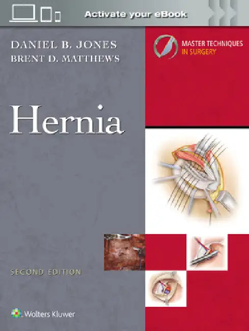 Master Techniques in Surgery: Hernia: Print + eBook with Multimedia by Daniel B. Jones, Brent D. Matthews