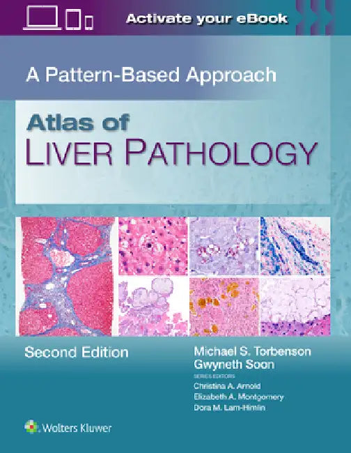 Atlas of Liver Pathology: A Pattern-Based Approach by Michael Scott Torbenson, Gwyneth Soon