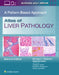 Atlas of Liver Pathology: A Pattern-Based Approach by Michael Scott Torbenson, Gwyneth Soon