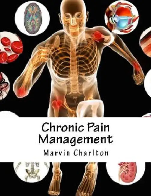 Chronic Pain Management by Marvin Charlton