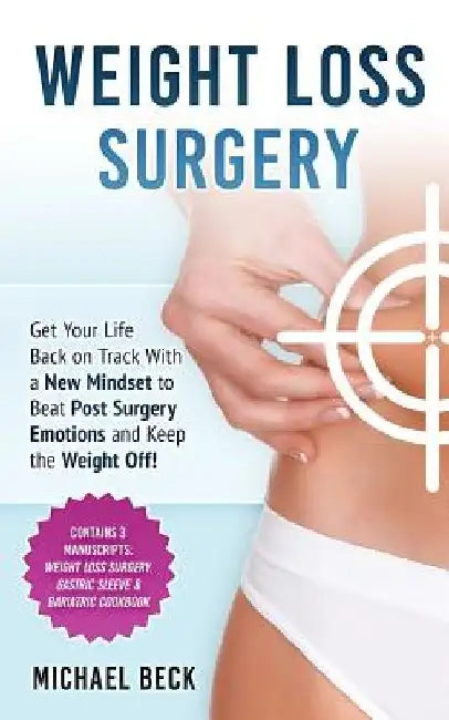 Weight Loss Surgery: Get Your Life Back on Track With a New Mindset to Beat Post Surgery Emotions and Keep the Weight Off! (Contains 3 Manu by Michael Beck