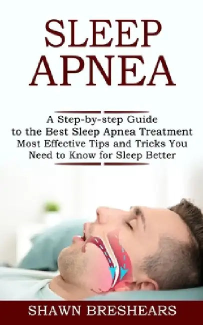 Sleep Apnea: A Step-by-step Guide to the Best Sleep Apnea Treatment (Most Effective Tips and Tricks You Need to Know for Sleep Bett by Shawn Breshears
