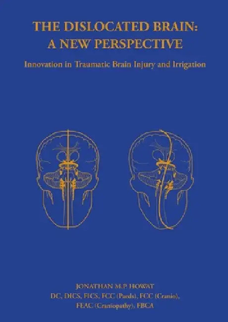 The Dislocated Brain: A New Perspective by Jonathan Howat