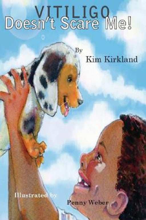 Vitiligo Doesn't Scare Me by Kim Kirkland