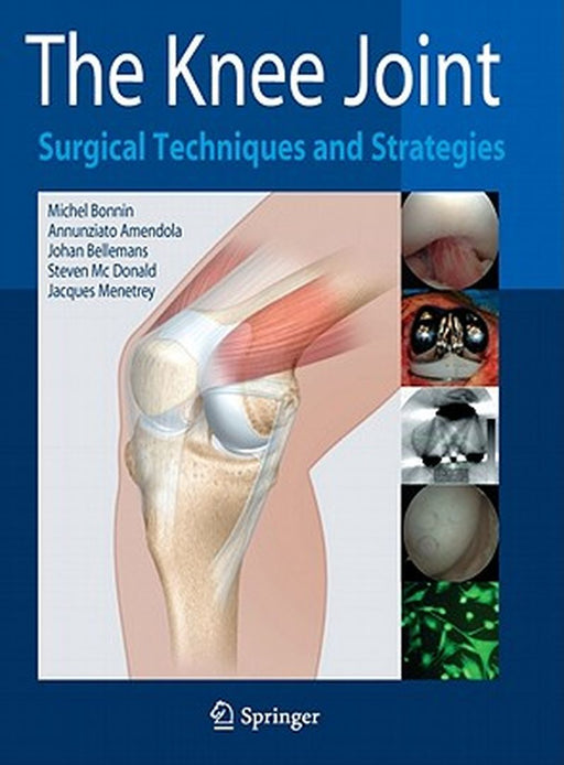 The Knee Joint: Surgical Techniques and Strategies by Michel Bonnin